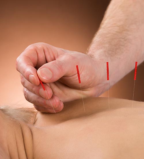 Acupressure Therapy